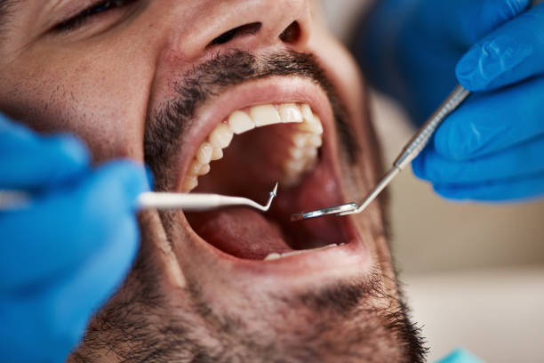 Best Emergency Dental Care for Broken or Chipped Teeth in Dalhart, TX